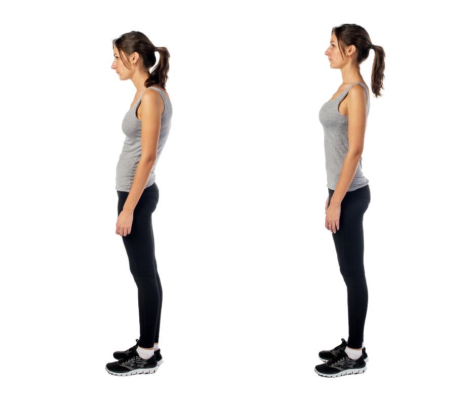 rounded shoulders posture