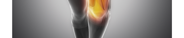 Why Inner Quad Gets Blamed for Knee Pain
