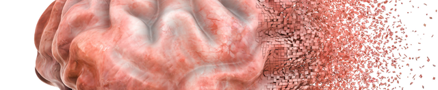 Could Alzheimer’s Disease Be Linked to “Type 3 Diabetes”?